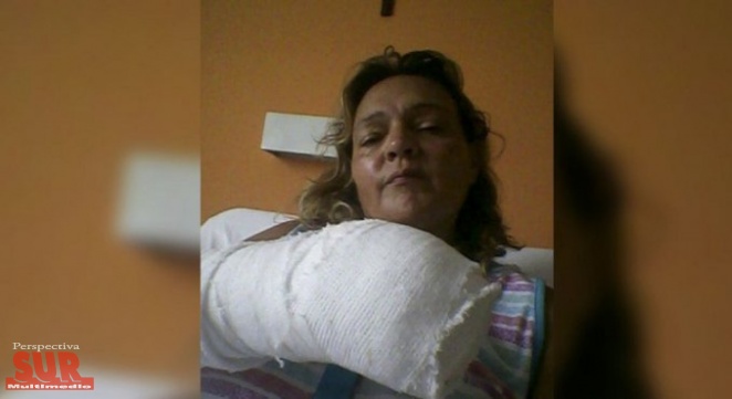 Berazategui: Le cortaron tres dedos de una mano a una mujer polica