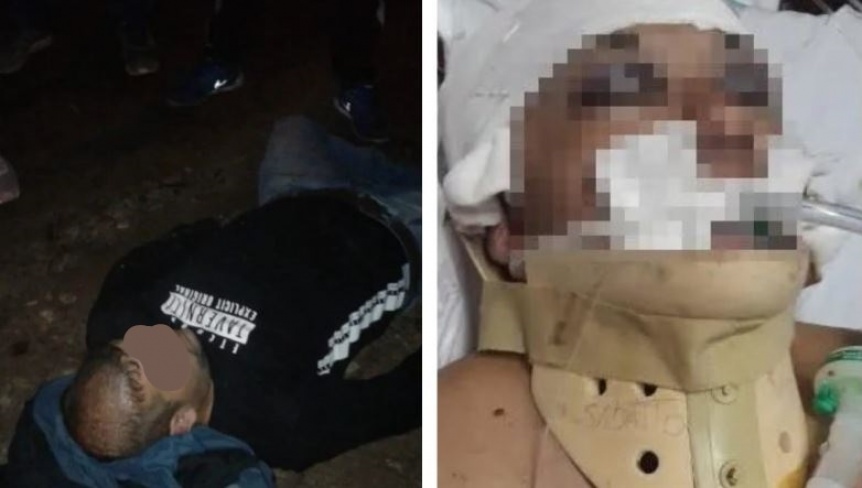 Brutal paliza a un vecino en Berazategui: Tiene muerte cerebral