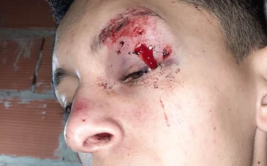Denuncian a patovicas por golpear a un joven en boliche de Quilmes Oeste